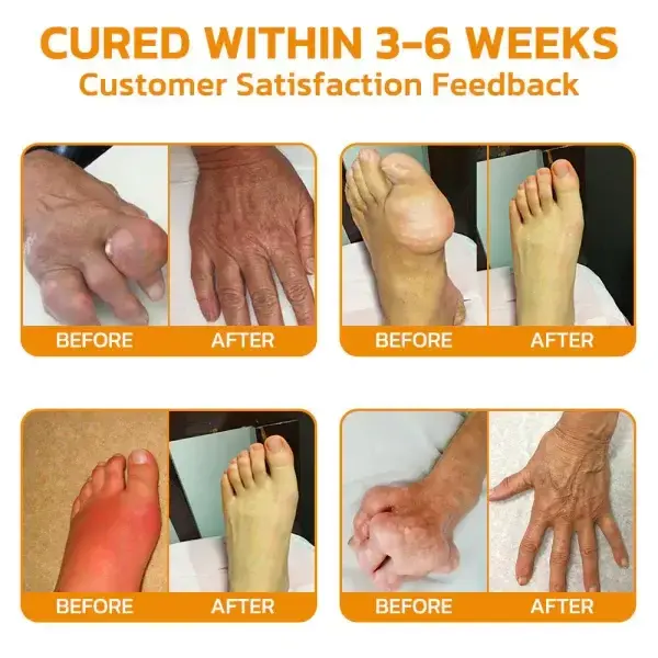 Bee Venom Pain Suppression Joint Healing Cream - Trusted by Medical Experts! - Image 4