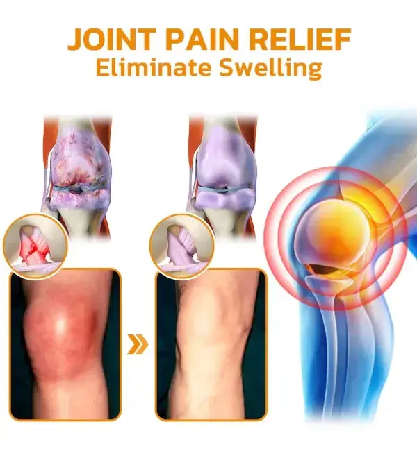 Bee Venom Pain Suppression Joint Healing Cream - Trusted by Medical Experts! - Image 8