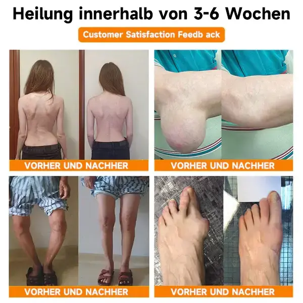 Bienengift- und Kurkuma-Gelenk- und Knochenschmerzlinderungscreme - Image 14