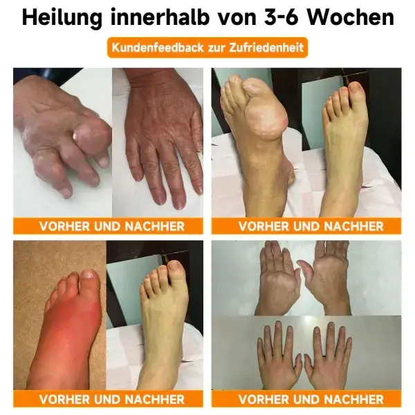 Bienengift- und Kurkuma-Gelenk- und Knochenschmerzlinderungscreme - Image 3