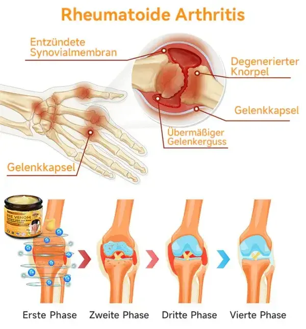 Bienengift- und Kurkuma-Gelenk- und Knochenschmerzlinderungscreme - Image 7