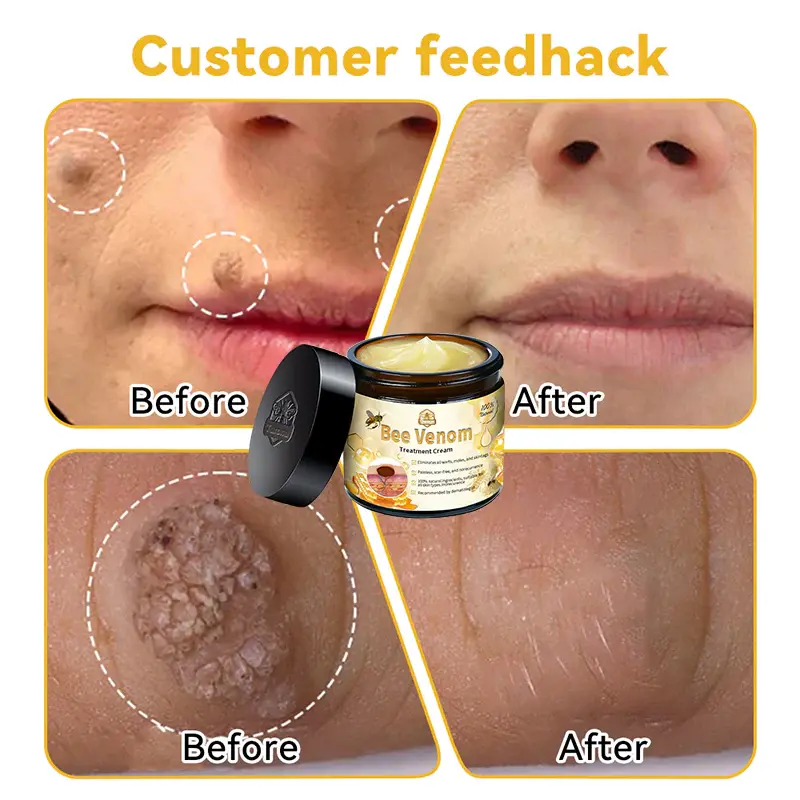 Bee Venom Skin Treatment Cream - Image 6