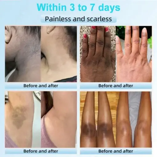 Exfoliating Cream for Dark Spots & Firmer Skin - Image 2