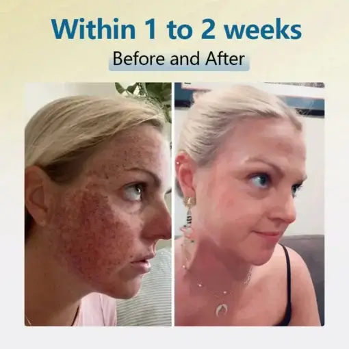 Bean Essence Serum - Image 2