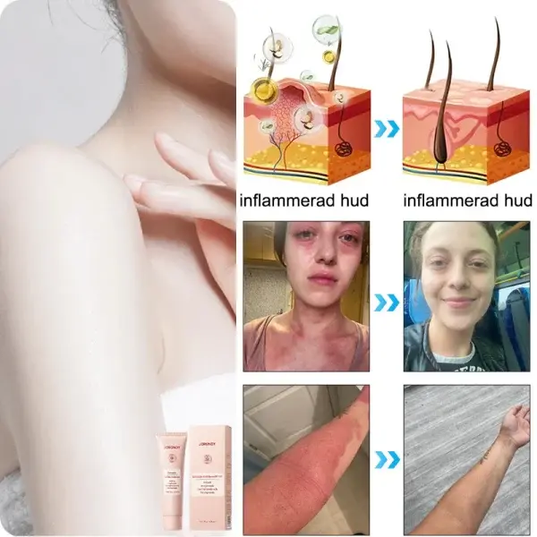 Purifying Peeling Gel - Image 10