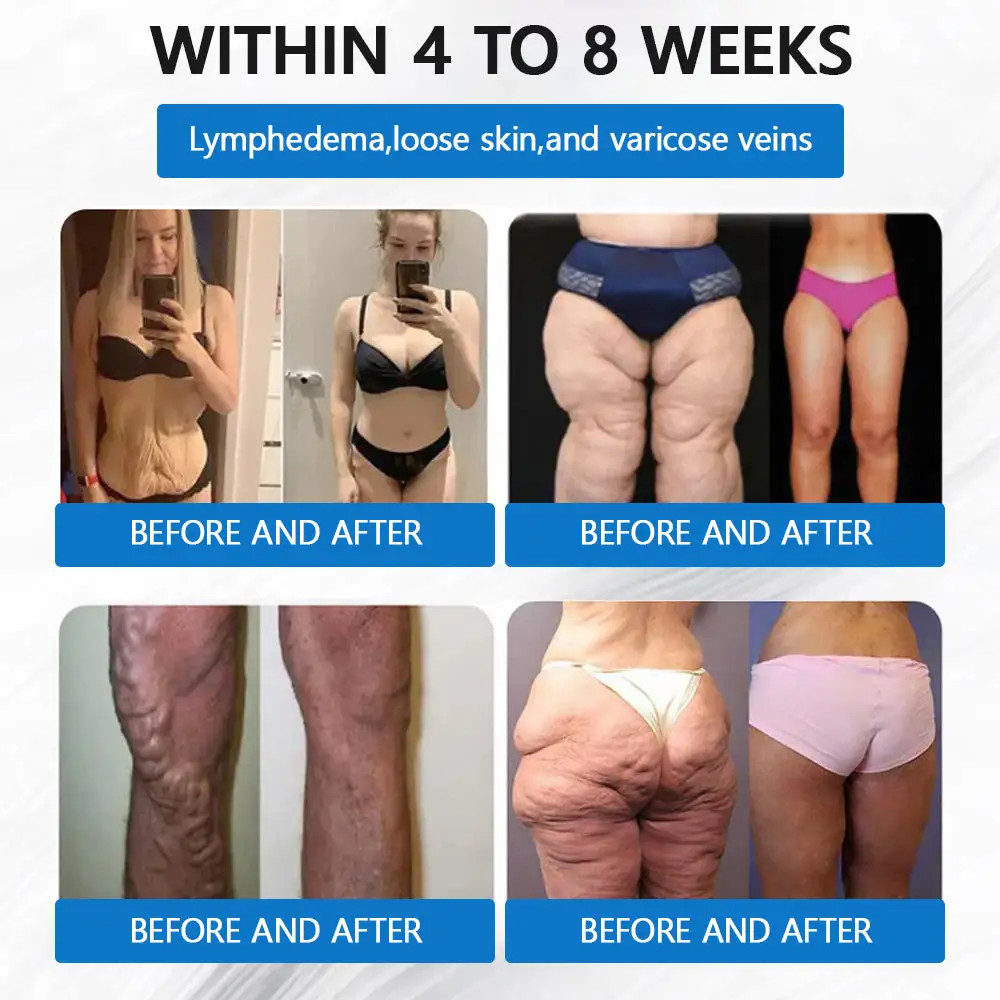 Nano Microneedle Weight Loss Patch - Image 6