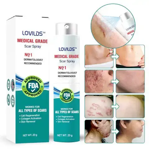 Advanced Scar Spray For All Types of Scars - Image 4