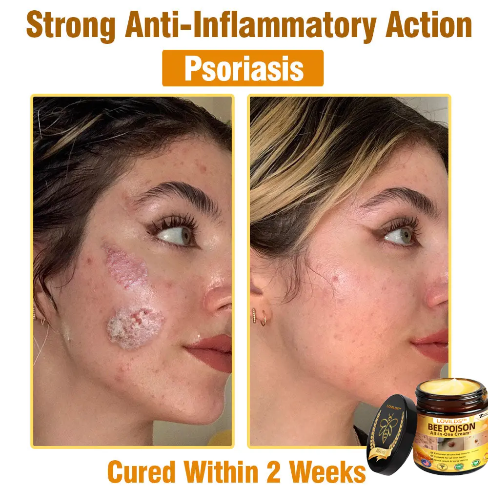Bee Poison All-in-One Cream US Dermatologist Approved - Image 4