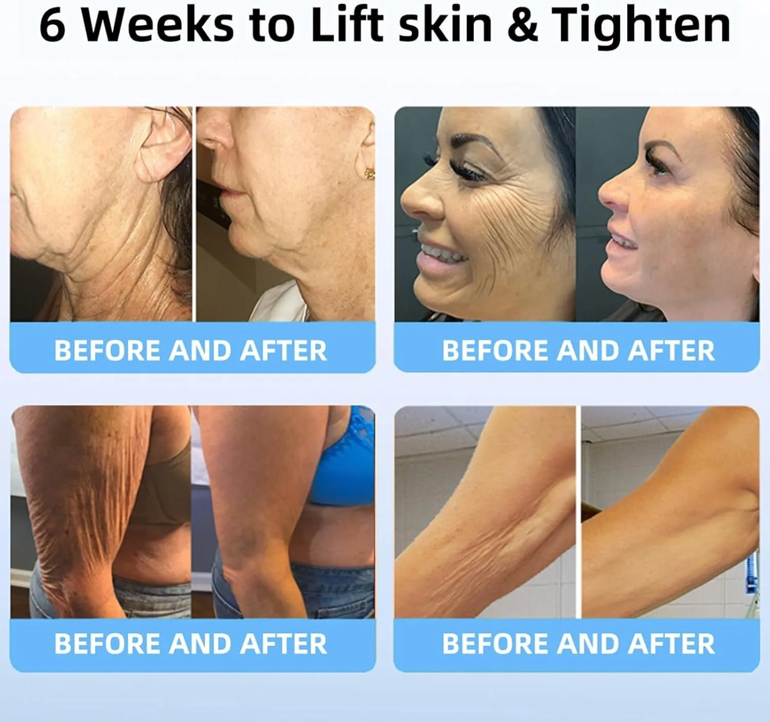 Bee Toxin Lift Cream - Image 7