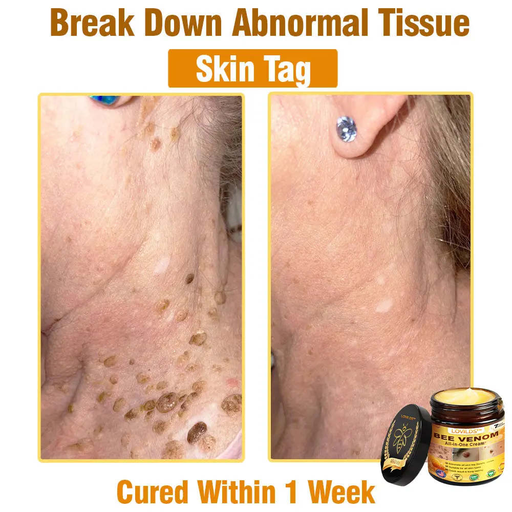 Bee Venom Cream – Anti-Aging Hydrating & Skin Repair - Image 18
