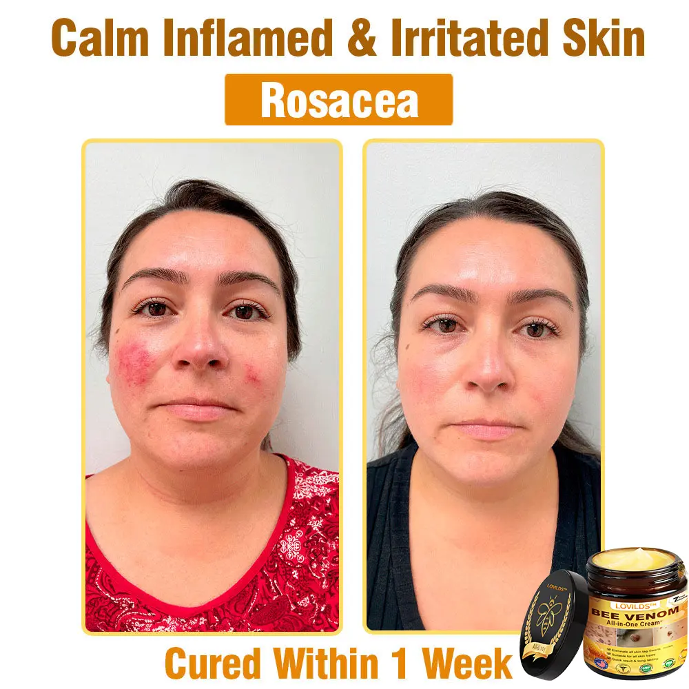 Bee Venom Cream - Image 17