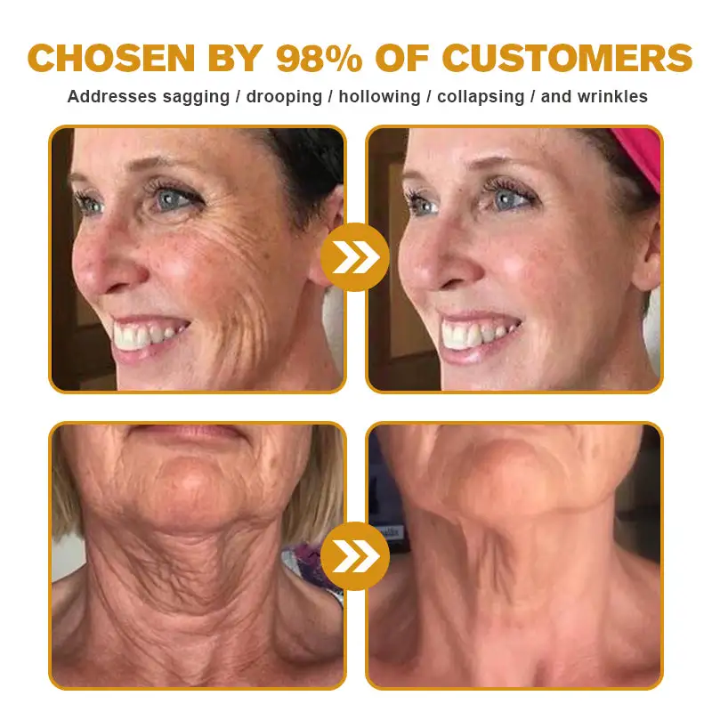 Botox Bee Venom Wrinkle Removal Cream - Image 8