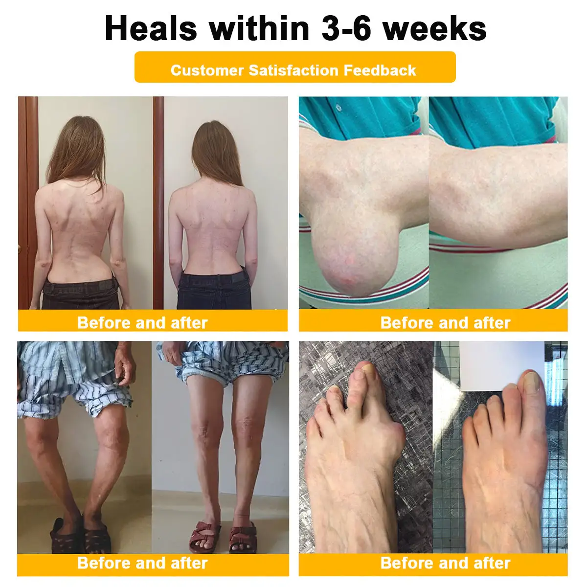 Botulinum Toxin & Bee Poison Pain-Relief Bone Healing Cream - Image 12