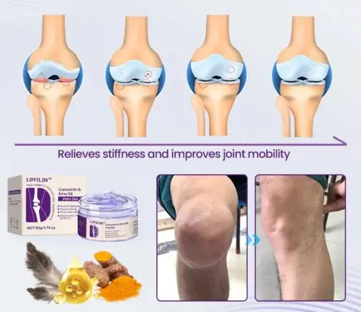 Curcumin & Emu Oil Pain Gel - Image 9