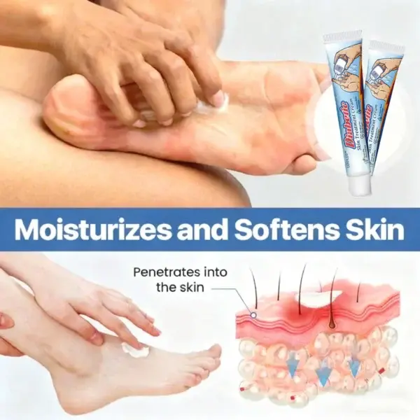 Diabetic Skin Treatment Cream - Image 6