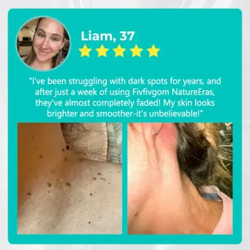 NatureErase Instant Mole & Spot Removal Gel - Image 5