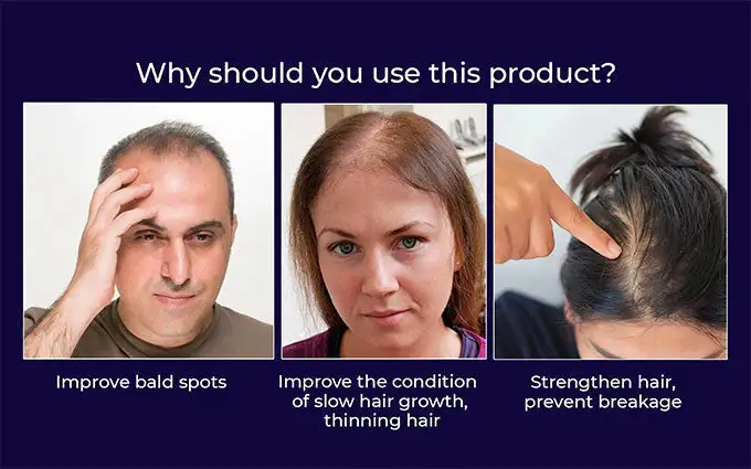 LOVILDS Natural Hair Regrowth Spray - Image 6