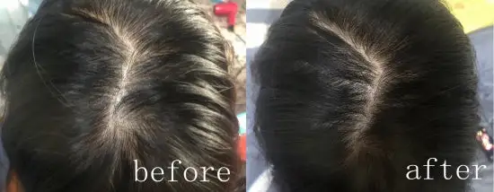 Hair Restoration Spray - Image 8