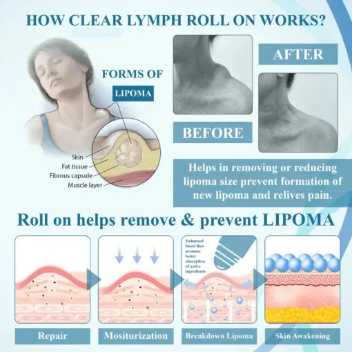 LumpsClear Lymph Say Goodbye to Lipomas and Swelling - Image 8