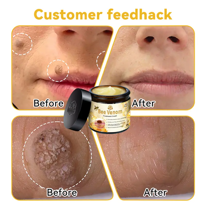 Bee Venom Skin Treatment Cream - Image 4