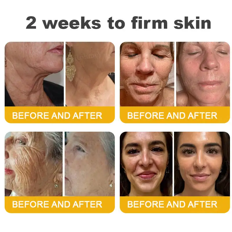 Botox Bee Venom Wrinkle Removal Cream - Image 5