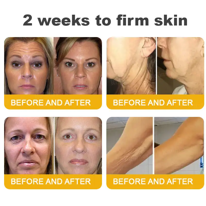Botox Bee Venom Wrinkle Removal Cream - Image 6