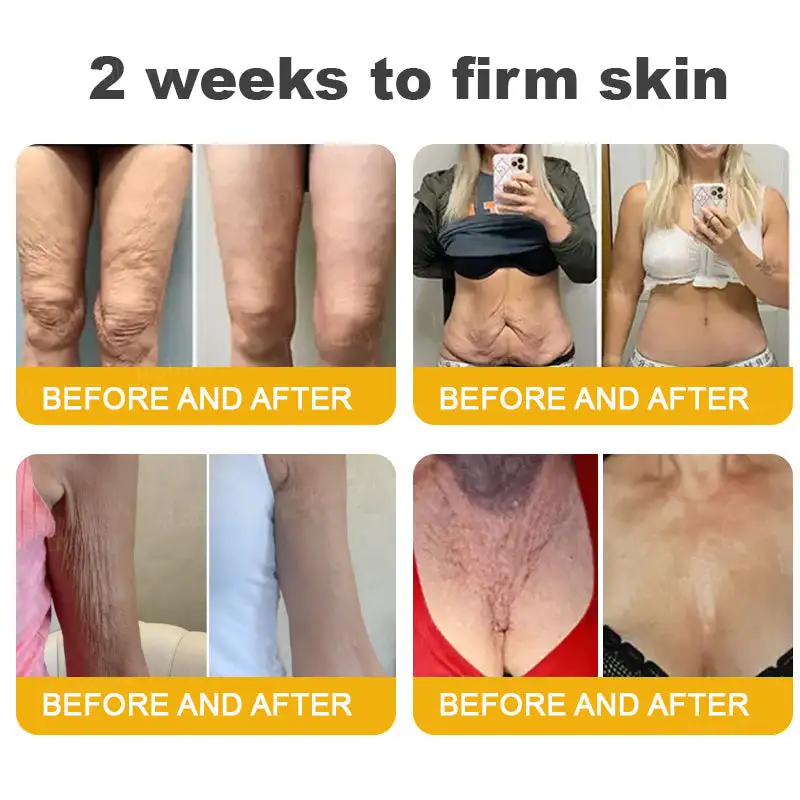 Botox Bee Venom Wrinkle Removal Cream - Image 7