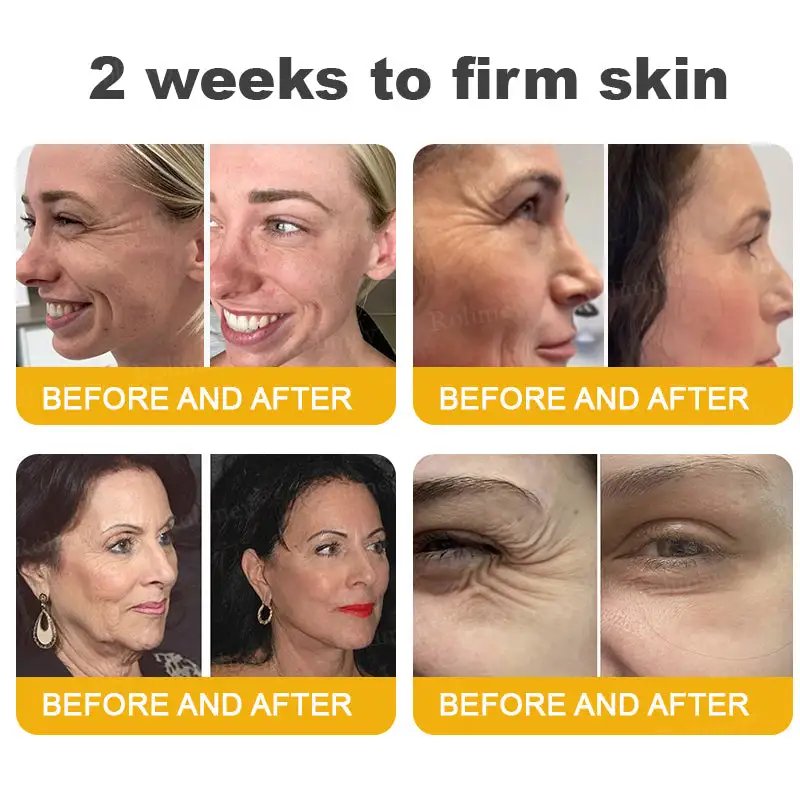 Botox Bee Venom Wrinkle Removal Cream - Image 8