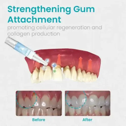 Gum Shield Therapy Gel - Image 8