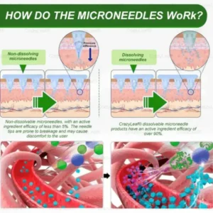 Nano Microneedle Patch