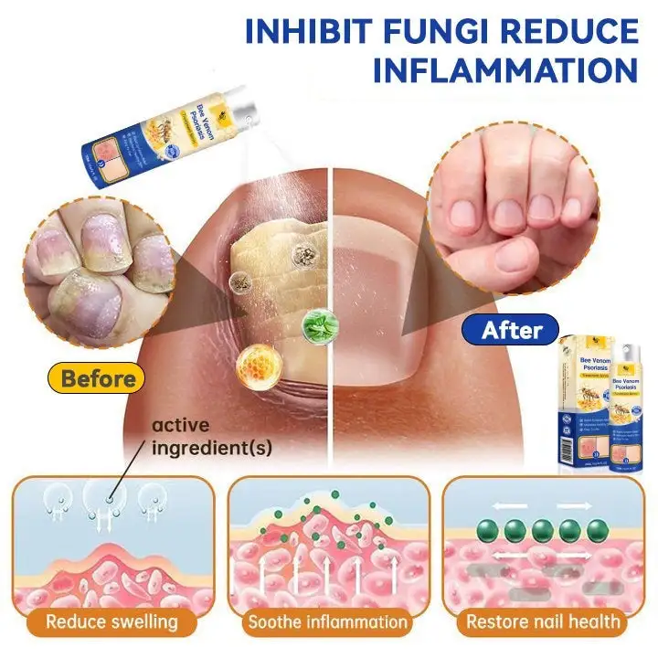 PsoriaHeal psoriasis Spray - Image 8