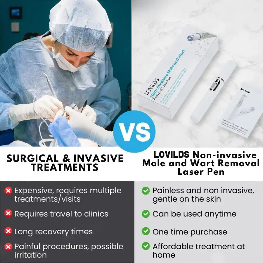 Non-Invasive Mole and Wart Removal Laser Pen - Image 10