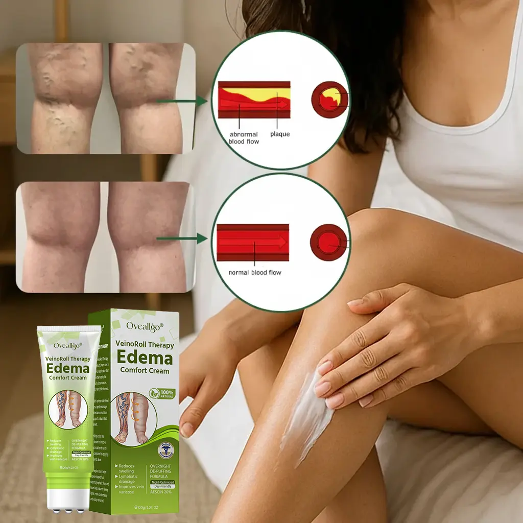 VeinoRoll Therapy Edema Comfort Cream - Image 9