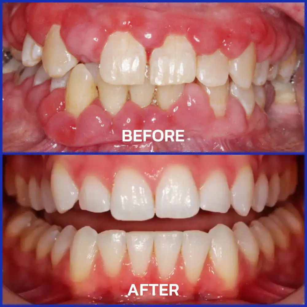 VioGloss Bienengift-Zahntherapie Oral Power - Image 2