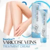 Varicose Veins Treatment Cream