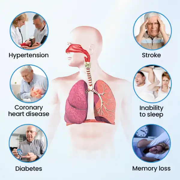 SnoreLess Nasal Breather