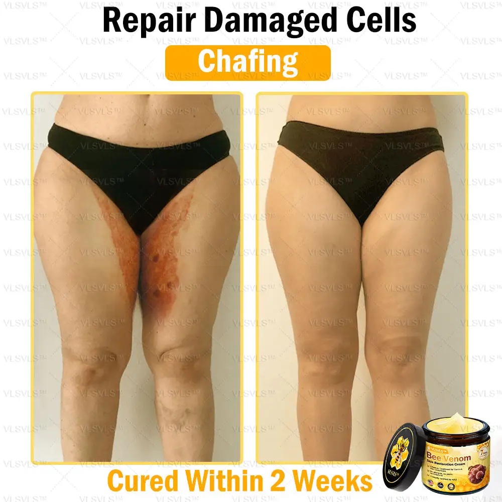 Special Sale Bee Venom Skin Restoration Cream - Image 10