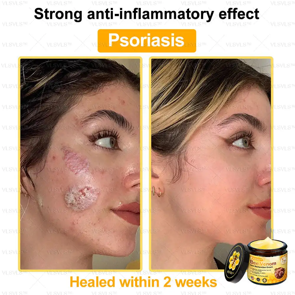 Special Sale Bee Venom Skin Restoration Cream - Image 3