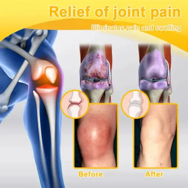 Botulinum Toxin & Bee Venom Pain-Relief Bone Healing Cream - Image 10