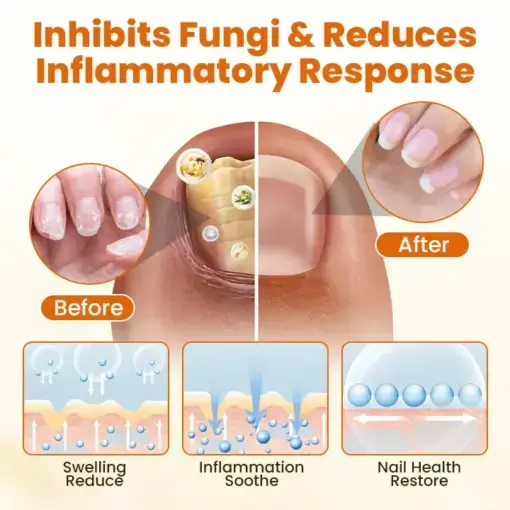 FungiBee Advanced Nail Repair Spray - Image 2