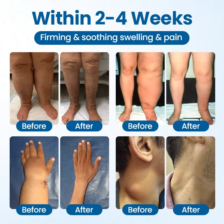 Lymphora Swelling Relief Roll-On - Image 3