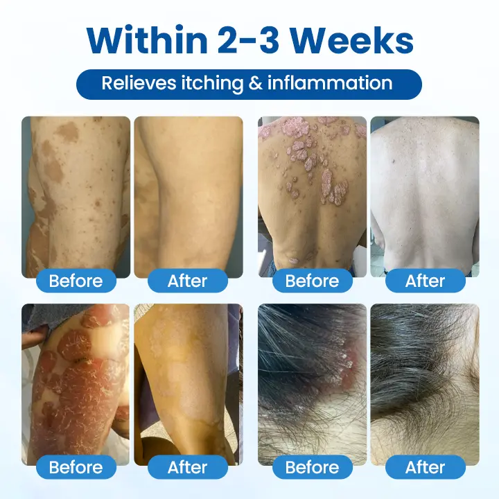 Magnesium Herbal Treatment Spray - Image 5