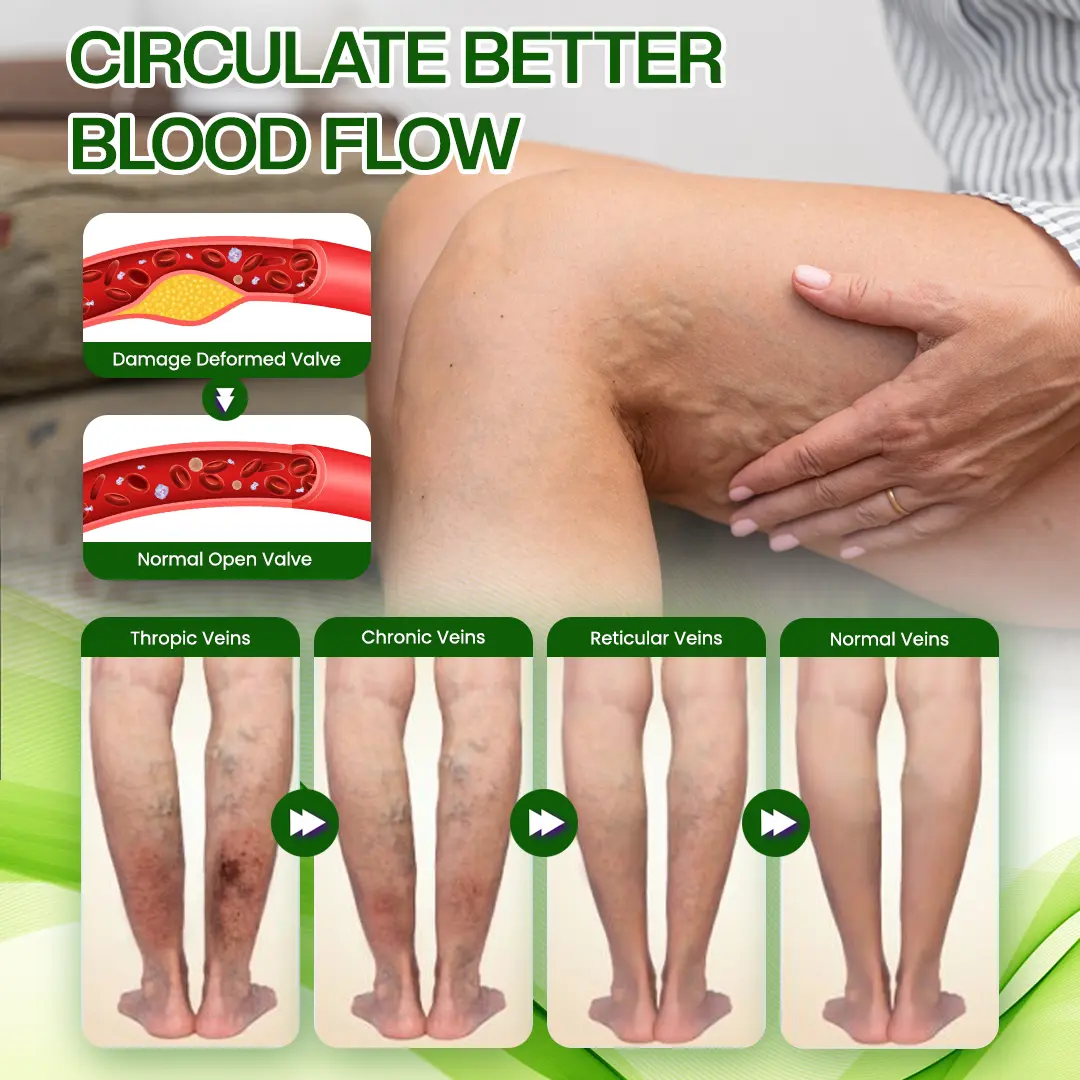 SwellRelief Horse Chestnut Edema Cream - Image 7