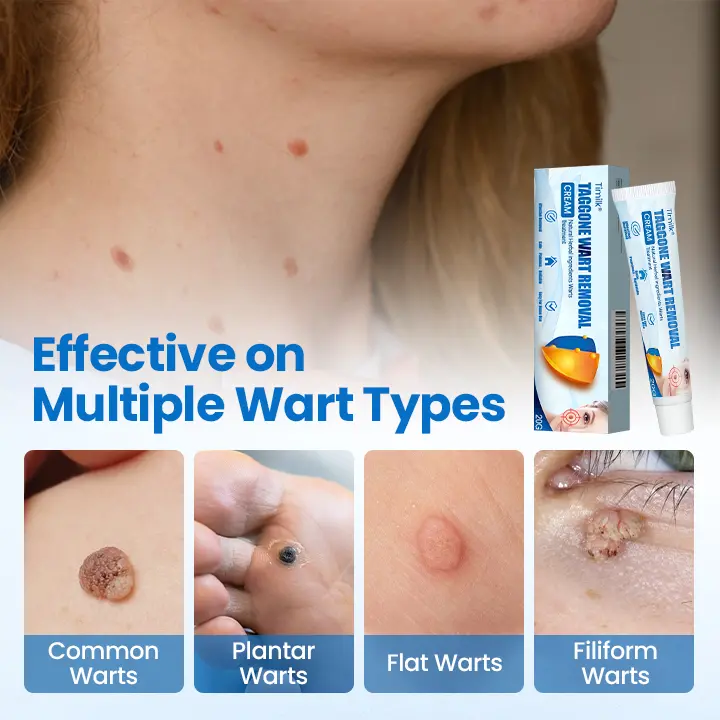 TagGone Wart Removal Cream - Image 5
