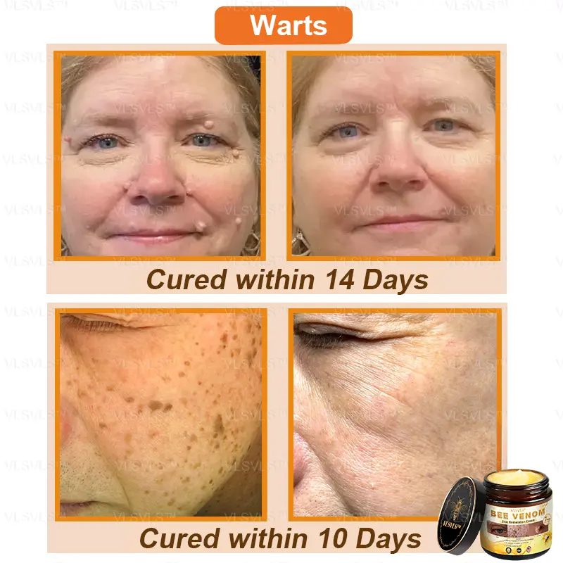 Bee Venom Skin Restoration Cream - Image 3
