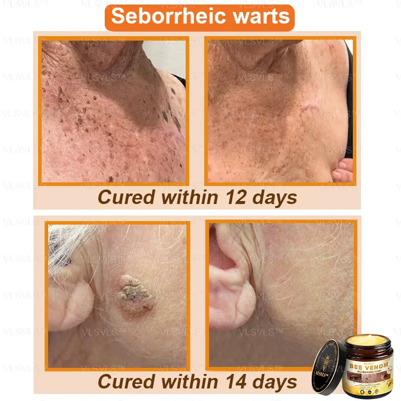 Bee Venom Skin Restoration Cream - Image 5