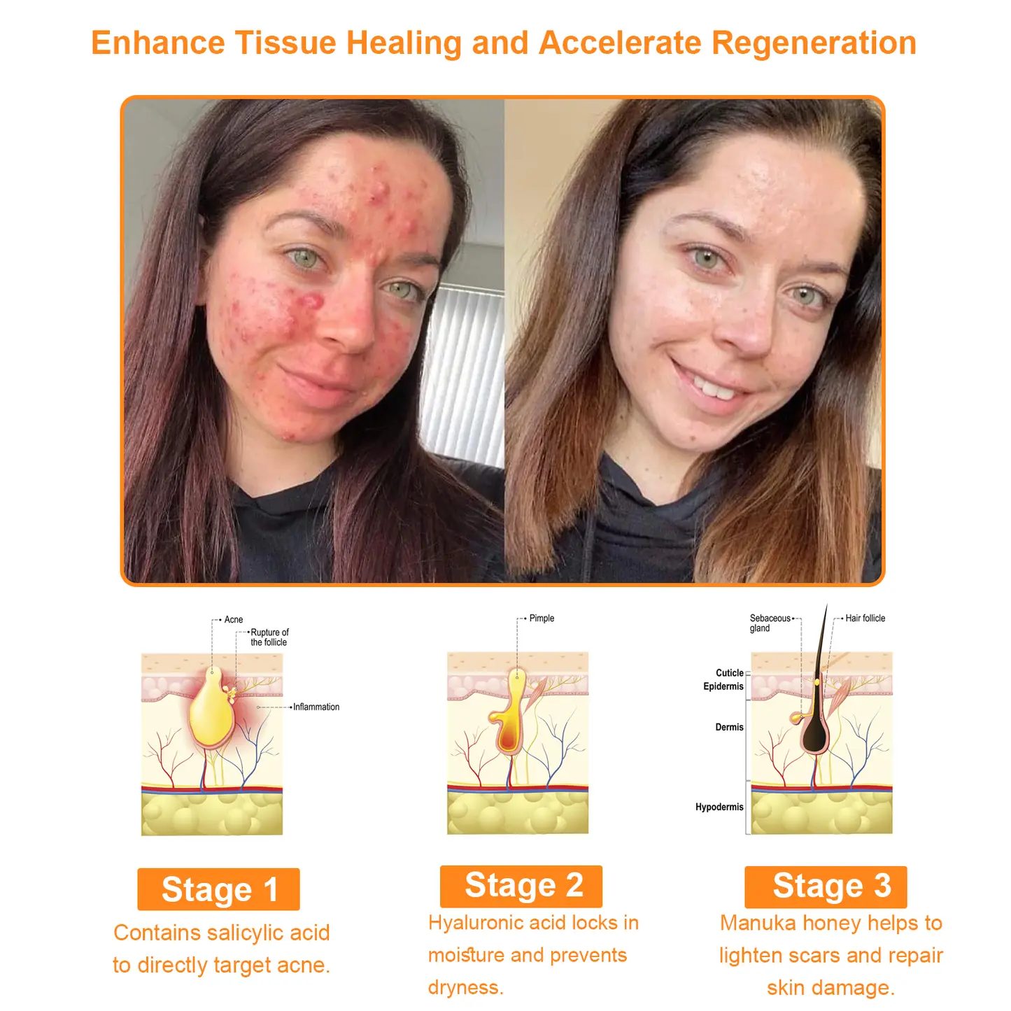 Bee Venom Skin Restoration Cream - Image 5