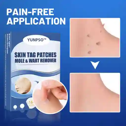 Moles & Warts Removing Skin Tag Patch - Image 4