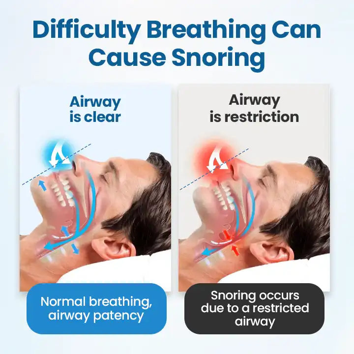SnoreLess Nasal Breather - Image 5