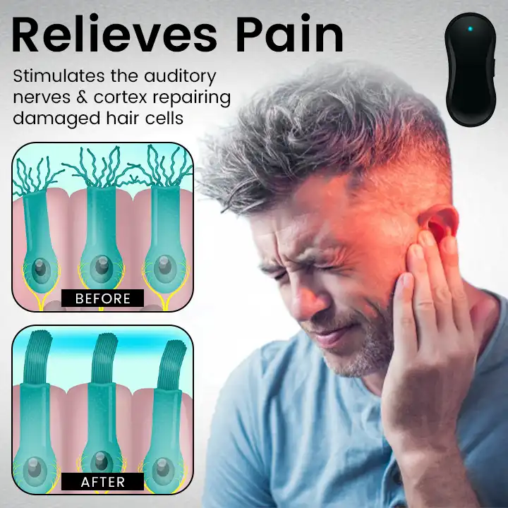 Tinnitus Relief Device Serenity - Image 6